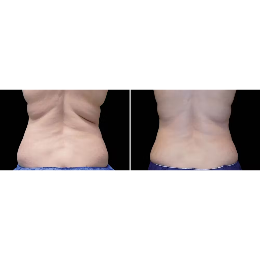 does tenncare cover glp-1 for weight loss Best Supplements to Take with Medications 12 Best GLP-1 Clinics in